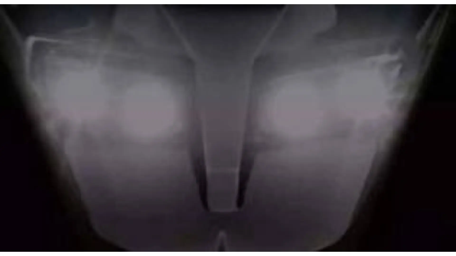 Teaser for the new TVS Ntorq 150 launching in September